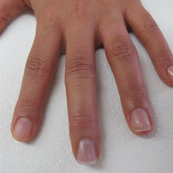 Fingers